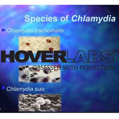 Chalmydia Species Summary Model