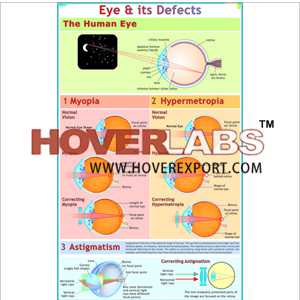 The Eyes : Its Defects & Remedies