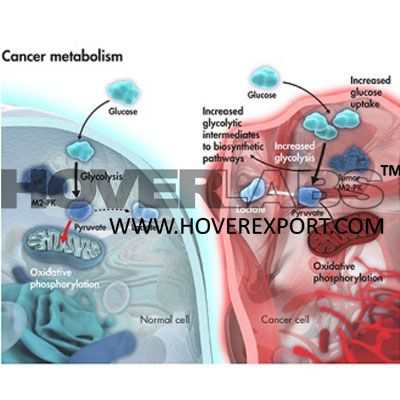 Cancer Metabolism Model