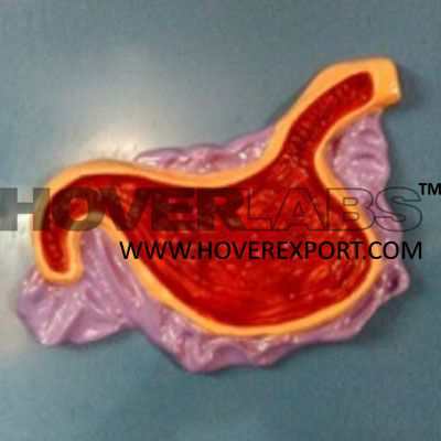 Stomach, Poisoned by Oxalic Acid Stragulation with Nylon Rope Injury in Cutous Hymen Cribiriform Model