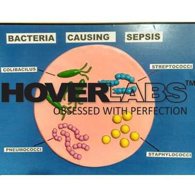 Bacteria Causing Sepsis Model