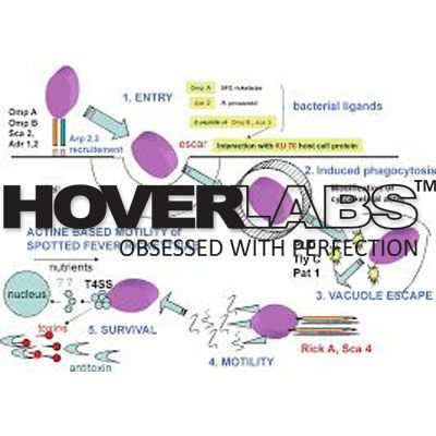 Micrograph, Spotted Fever and Rickettsia Disease Model