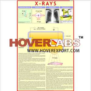 X-Rays