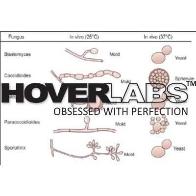 Classification of Pathogenic Fungi Model