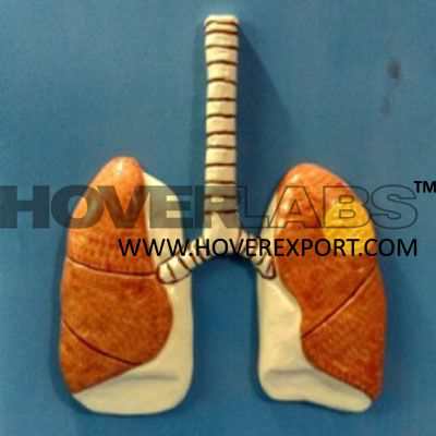 T.B. Infliteration in Lungs Model