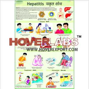 Hepatitis