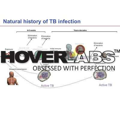 T.B.Infection Model