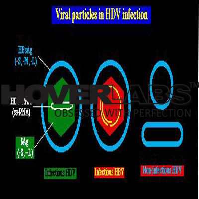 Classification of Hepatitis Virus Model