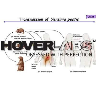 Epidemiology and Pathogenesis of Plague Model