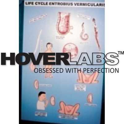 Life Cycle of Enterobius Vermicularies Model