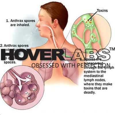 Bacillus Species Anthrax Model