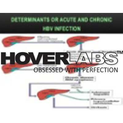 Typical Course of Hepatitis B Virus Acute Chronic Model