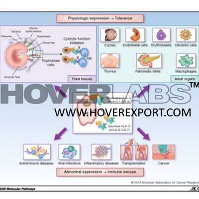 Hla Diseas Association and Transplantation Model