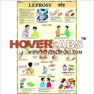 Leprosy