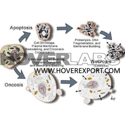 Biochemical Characteristics of Cancer Model