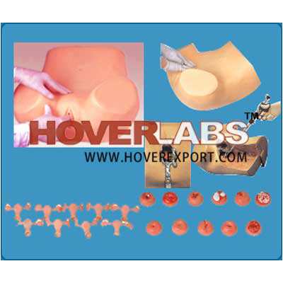 Gynecological Examination Model