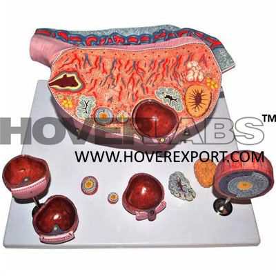 Model of Ovary Model